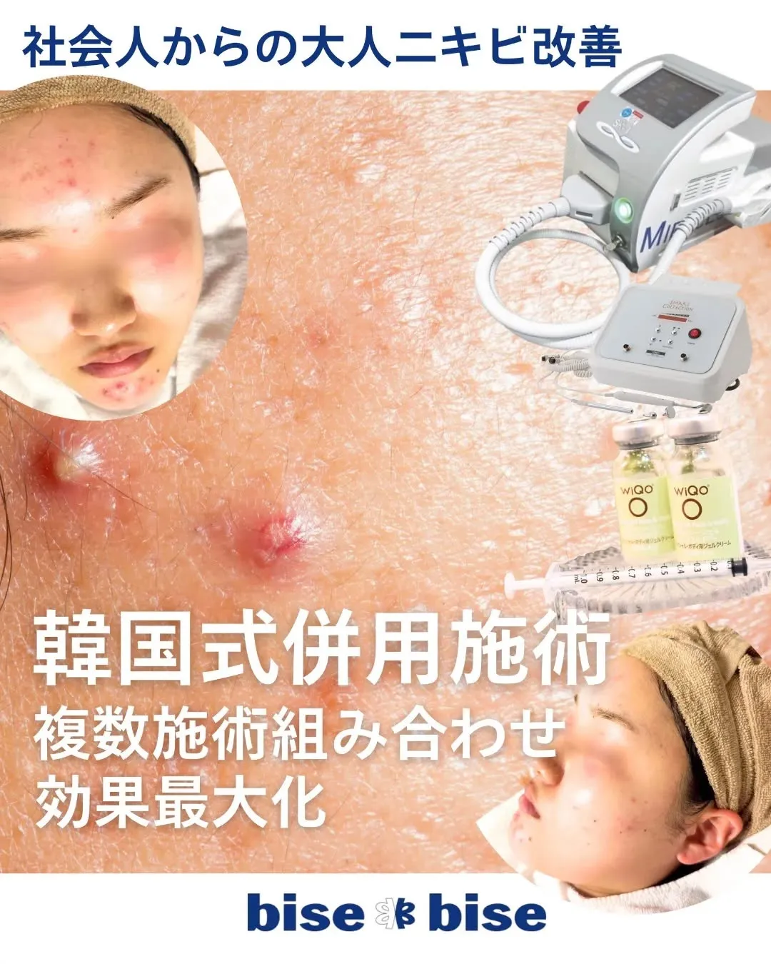 @nikibi₋bisebisetennoji スキンケア...